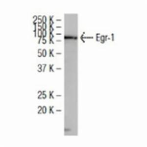 Santa Cruz EGR-1 ANTIBODY (S-25), 100 µg/ml SANTSC-101033 Santa Cruz EGR-1 ANTIBODY (S-25), 100 µg/ml SANTSC-101033