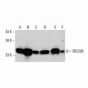 Santa Cruz SEC22B (29-F7), 100 µg/ml SANTSC-101267 Santa Cruz SEC22B (29-F7), 100 µg/ml SANTSC-101267