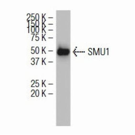Santa Cruz SMU1 (JS-12), 100 µg/ml SANTSC-100896