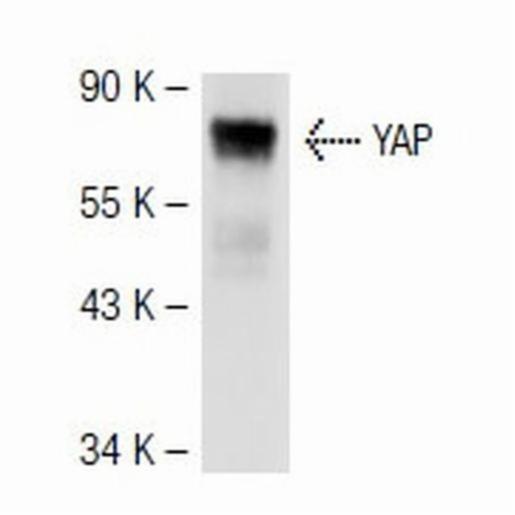 Santa Cruz MOUSE ANTI-YAP Full Length (63.7), 100 µG/ml-1 ml SANTSC-101199