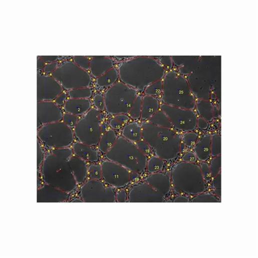 Ibidi , Tube Formation FastTrack AI Analysis Pack: 1000 Analysis Jobs, 32100-1000